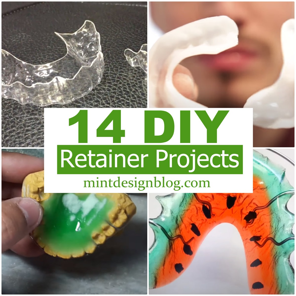 DIY Retainers A Comprehensive Guide for Makers Best Diy Pro